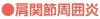 ●肩関節周囲炎
